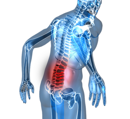 AFB_lumbar_pain.jpg AFB_lumbar_pain.jpg